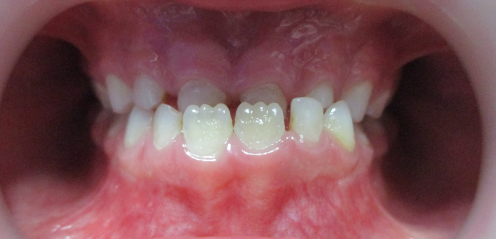 Antosia - zdjęcie przed