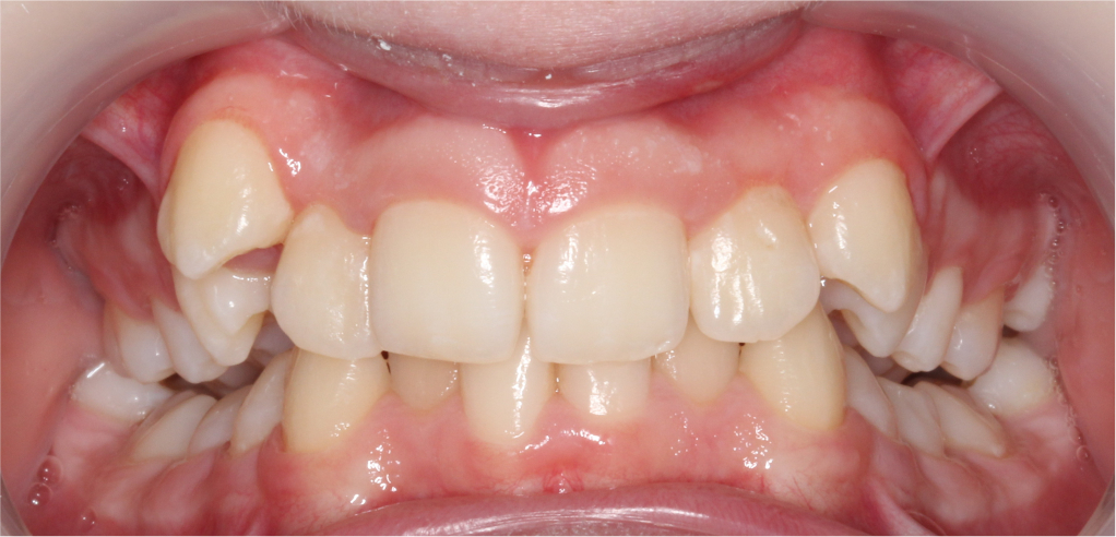 Dominika - zdjęcie przed