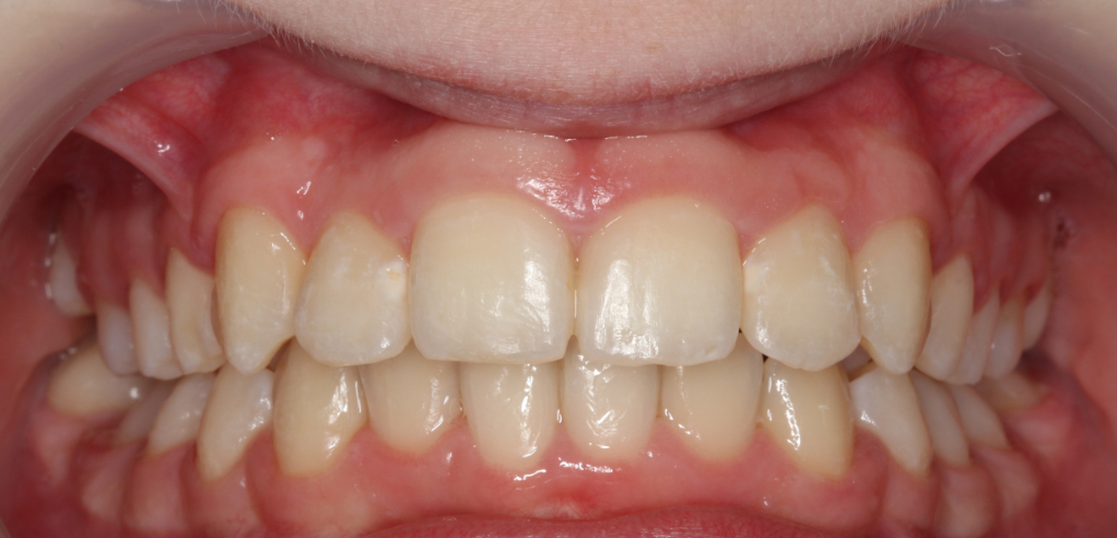 Dominika - zdjęcie po