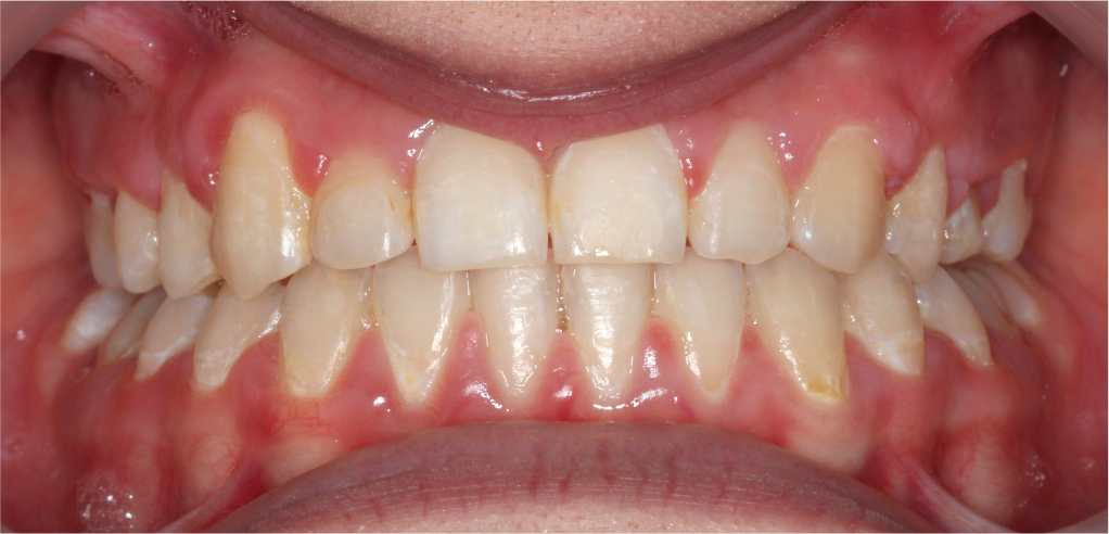 Wiktoria - zdjęcie po