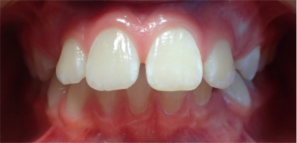 Igor - zdjęcie przed