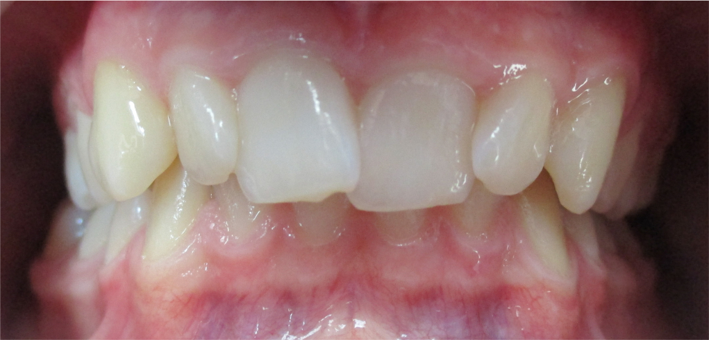 Karol - zdjęcie przed