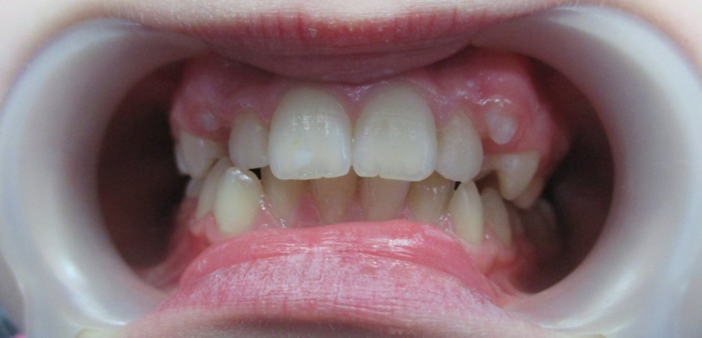 Nina - zdjęcie przed