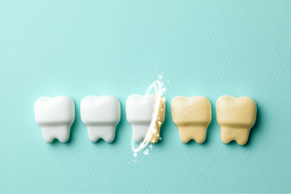 Zmiana koloru zębów