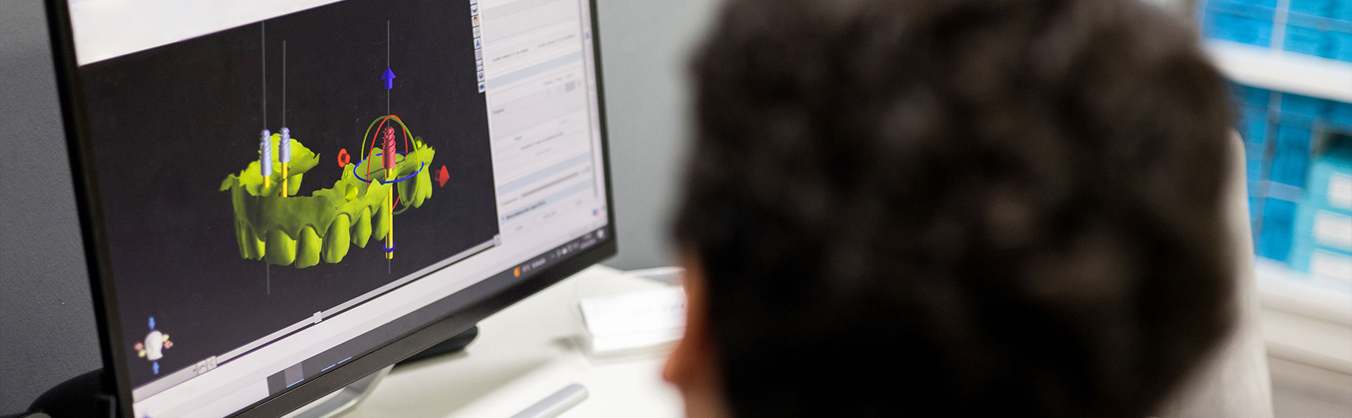 Implanty, chirurgia, rendgen na ekranie komputera